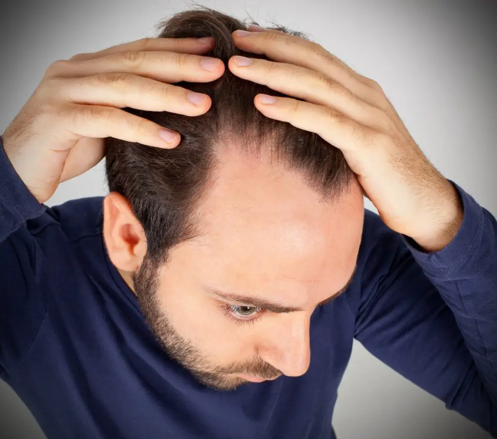 What Causes Hair Loss In 23 Year Old Tips For Hair Loss