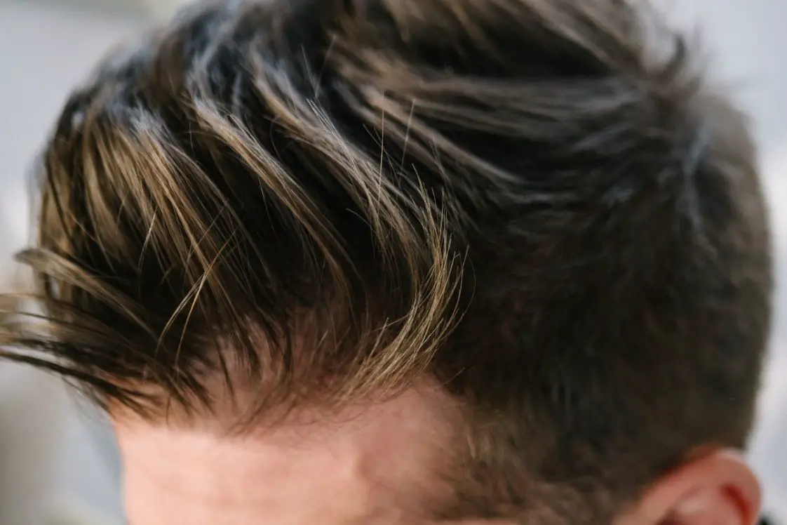 hairline receding caspa omhoog sluit penteado marrom pomades schuppe hairinstructions stilvollen modieuze